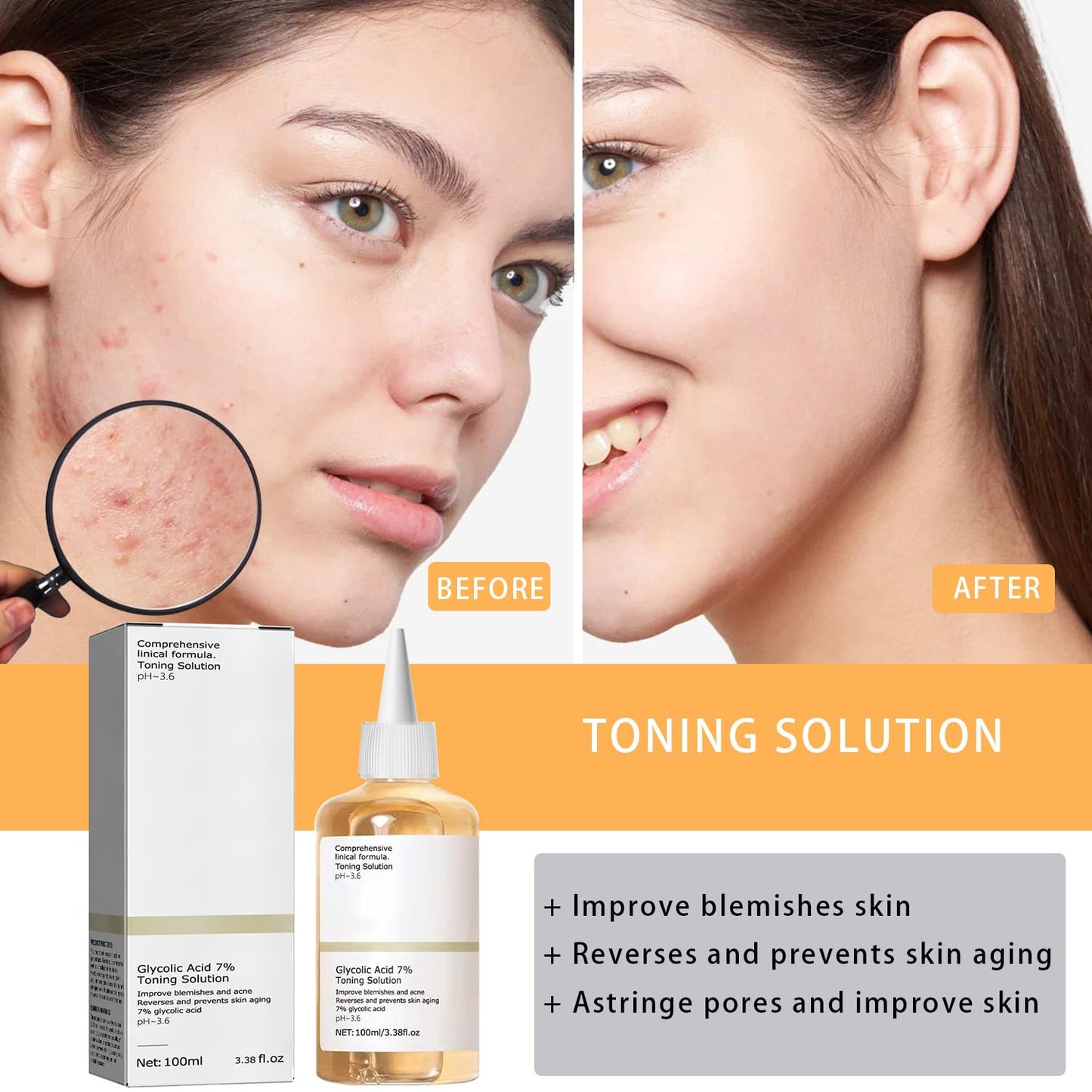 Ordinary Acid Toning Solution, Acid 7% Toner, Sour 7% Toning, Keep The Skin Moist, For Women All Skin Types (100ml*2Pcs)