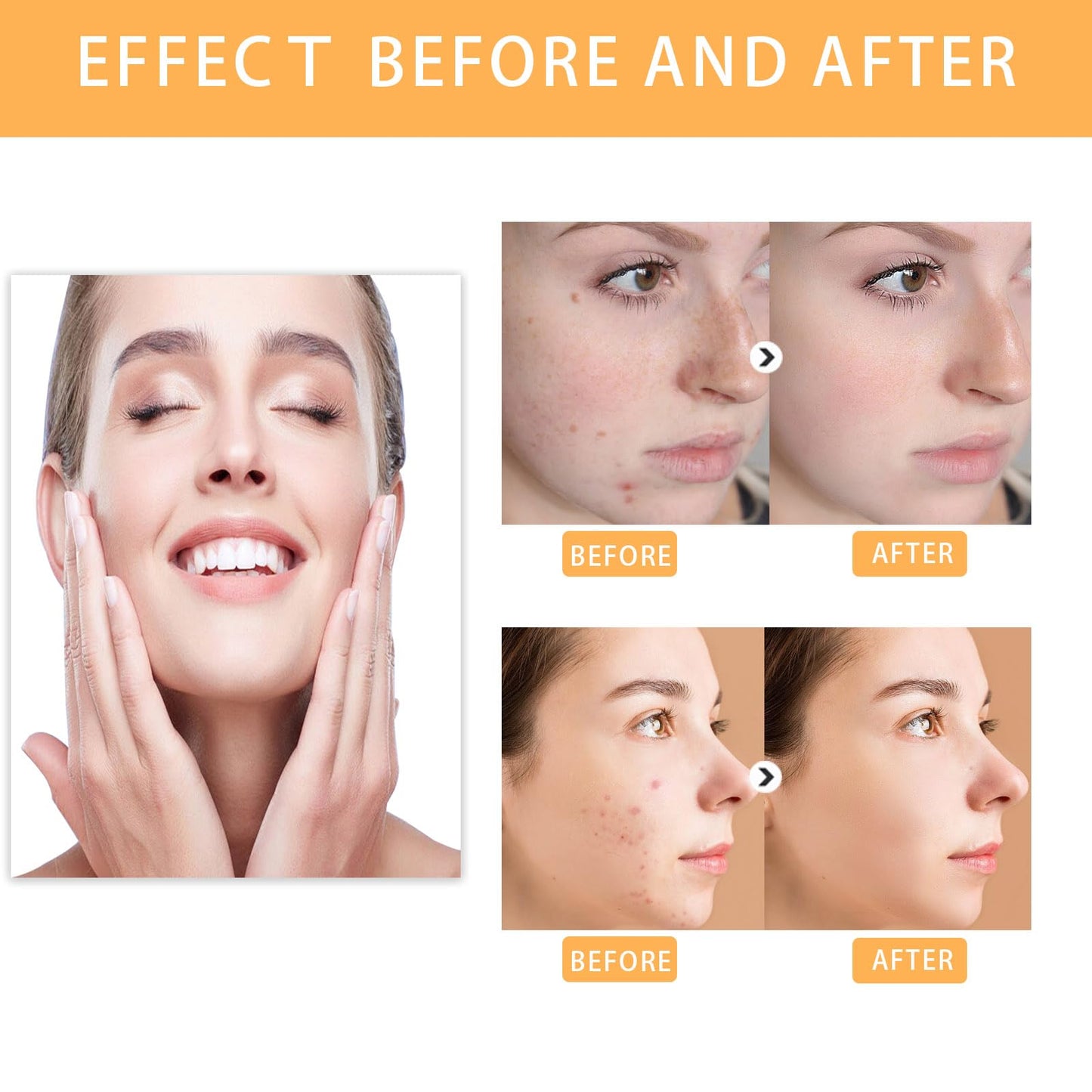 Ordinary Acid Toning Solution, Acid 7% Toner, Sour 7% Toning, Keep The Skin Moist, For Women All Skin Types (100ml*2Pcs)
